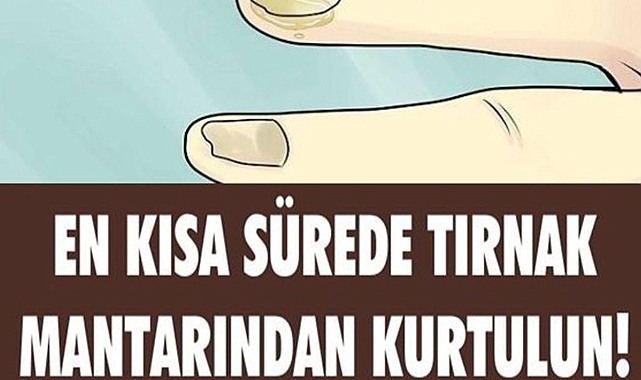 Tırnak Mantarına Doğal Çözümler
